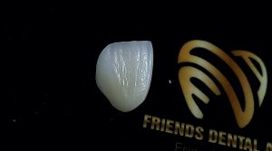 Friends Dental Laboratory