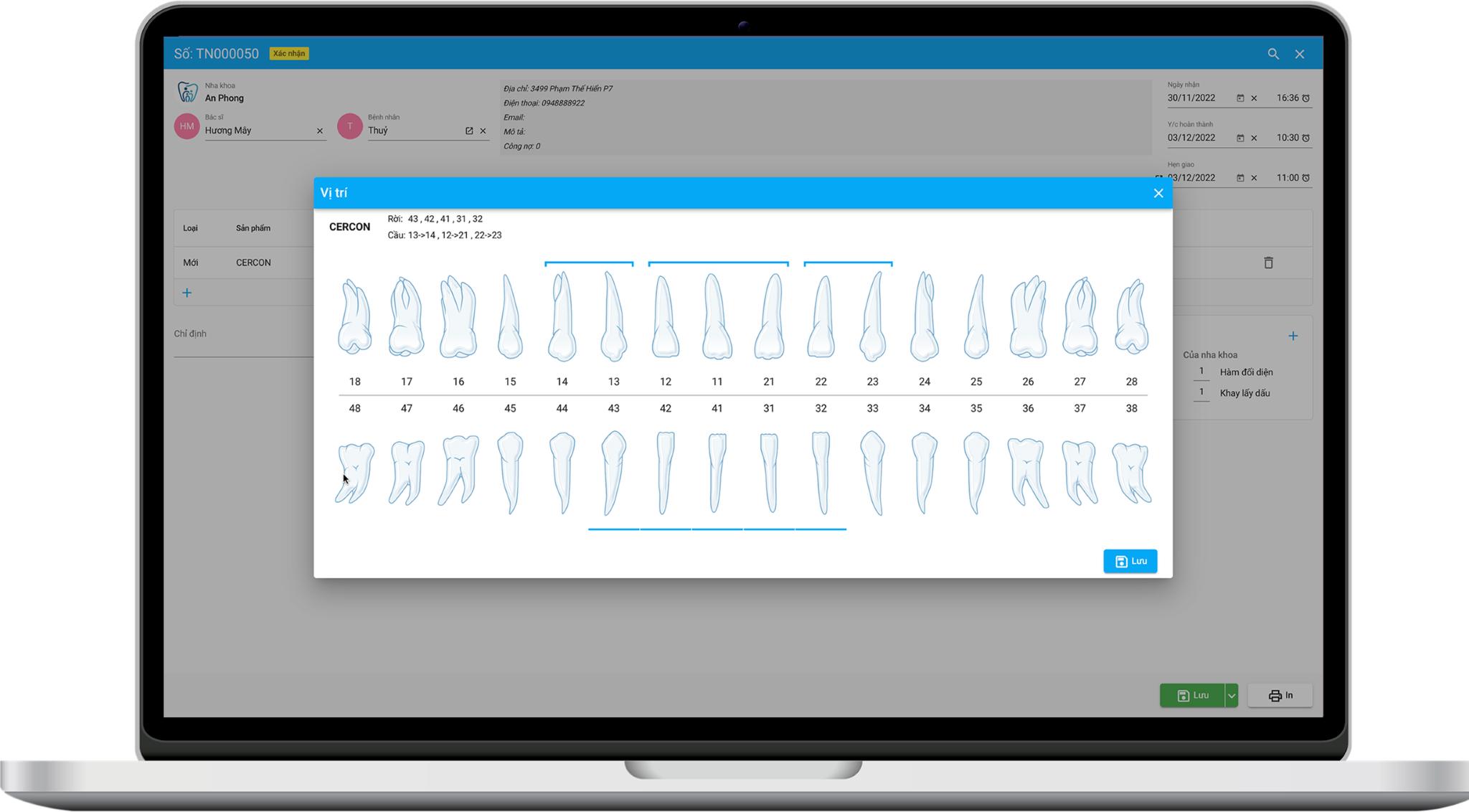 vDentalLab V2 Interface